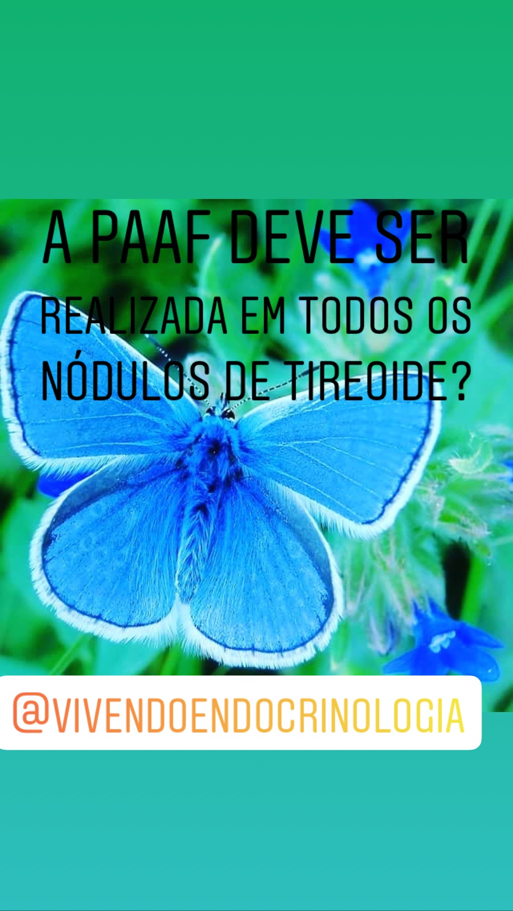 Punção de Nódulos de Tireoide