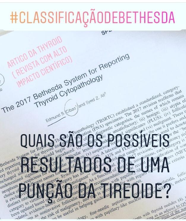 O que você sabe sobre punção da tireoide ( PAAF)?