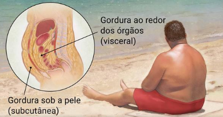 Obesidade